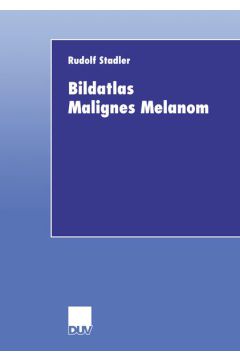 Bildatlas Malignes Melanom